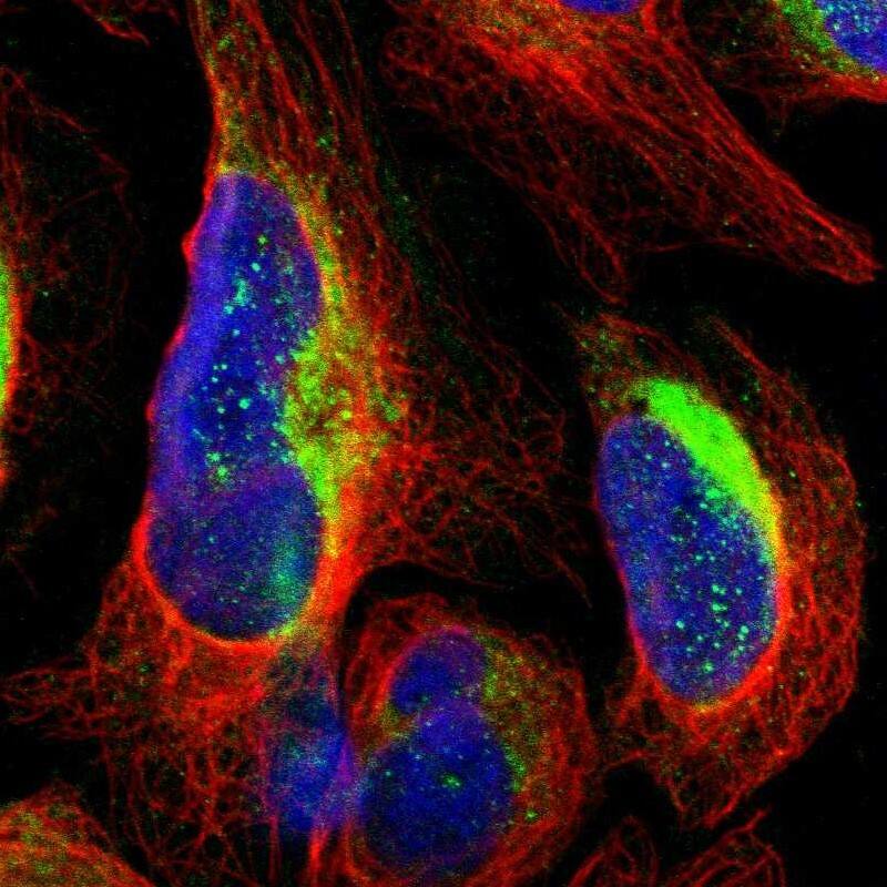 RHOT2 Antibody - BSA Free Immunocytochemistry/ Immunofluorescence: RHOT2 Antibody [NBP1-88982]
