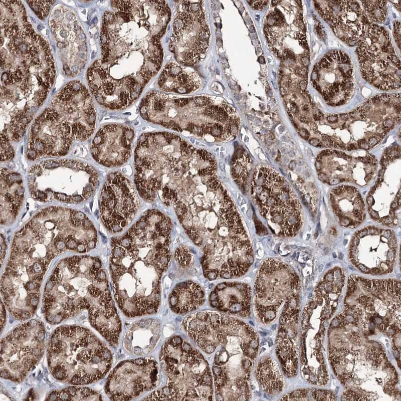 ACTR6 Antibody - BSA Free Immunohistochemistry-Paraffin: ACTR6 Antibody [NBP1-89000]