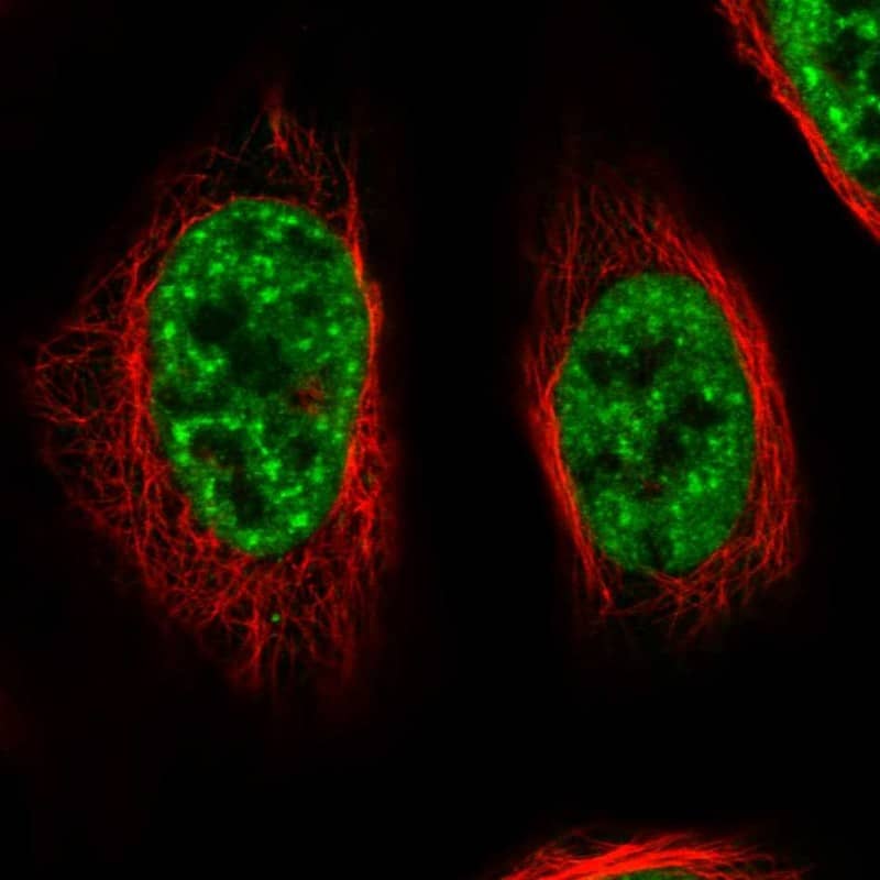 RBM26 Antibody - BSA Free Immunocytochemistry/ Immunofluorescence: RBM26 Antibody [NBP1-89007]