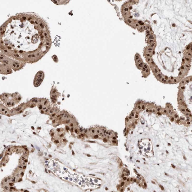 MED8 Antibody - BSA Free Immunohistochemistry-Paraffin: MED8 Antibody [NBP1-89015]