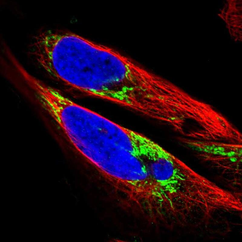 SLC25A13 Antibody - BSA Free Immunocytochemistry/ Immunofluorescence: SLC25A13 Antibody [NBP1-89019]