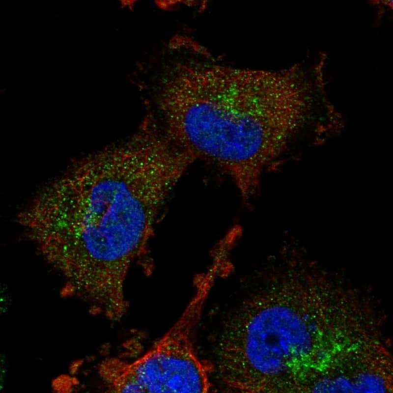 ADI1 Antibody - BSA Free Immunocytochemistry/ Immunofluorescence: ADI1 Antibody [NBP1-89037]