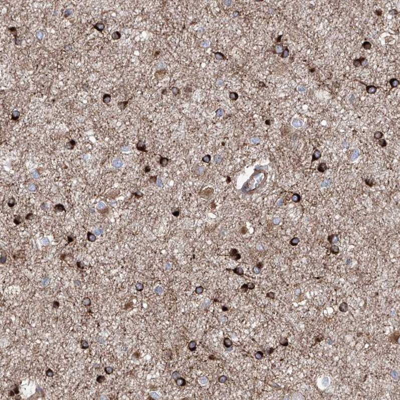 APAF-1 Antibody - BSA Free Immunohistochemistry-Paraffin: APAF-1 Antibody [NBP1-89050]