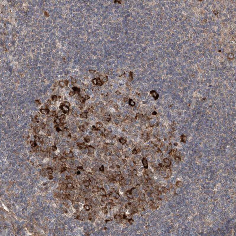 APAF-1 Antibody - BSA Free Immunohistochemistry-Paraffin: APAF-1 Antibody [NBP1-89050]
