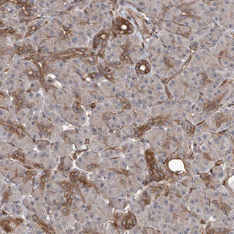APAF-1 Antibody - BSA Free Immunohistochemistry-Paraffin: APAF-1 Antibody [NBP1-89050]
