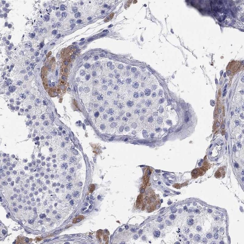 Aldehyde Oxidase 1/AOX1 Antibody - BSA Free Immunohistochemistry-Paraffin: Aldehyde Oxidase 1/AOX1 Antibody [NBP1-89071]