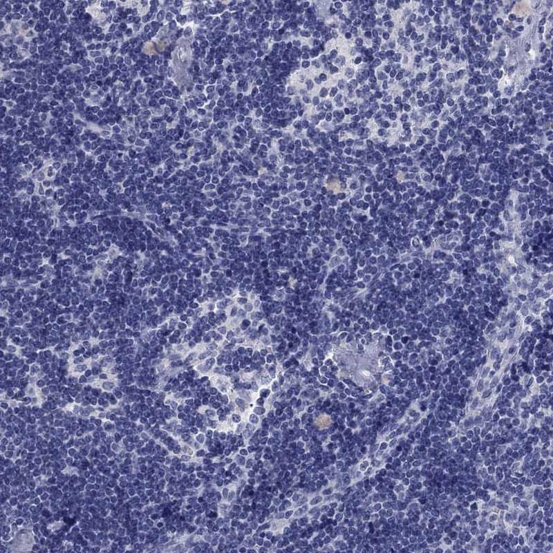 Aldehyde Oxidase 1/AOX1 Antibody - BSA Free Immunohistochemistry-Paraffin: Aldehyde Oxidase 1/AOX1 Antibody [NBP1-89071]