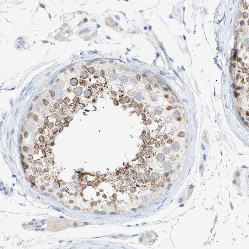 SLC25A31 Antibody - BSA Free Immunohistochemistry-Paraffin: SLC25A31 Antibody [NBP1-89074]