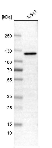 CDKL5 Antibody Western Blot: CDKL5 Antibody [NBP1-84881]