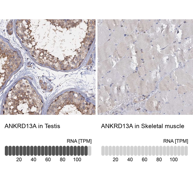 ANKRD13A Antibody - BSA Free Immunohistochemistry-Paraffin: ANKRD13A Antibody [NBP1-89082]