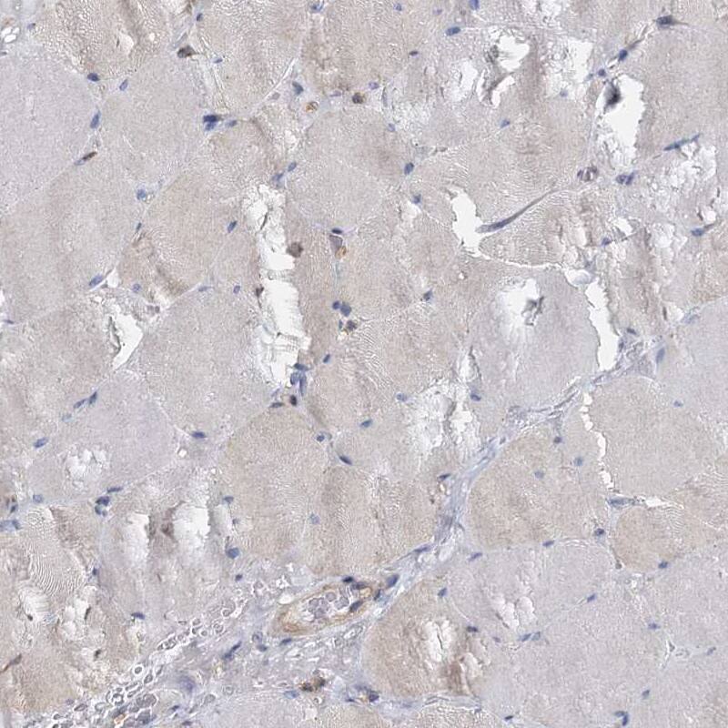 ANKRD13A Antibody - BSA Free Immunohistochemistry-Paraffin: ANKRD13A Antibody [NBP1-89082]