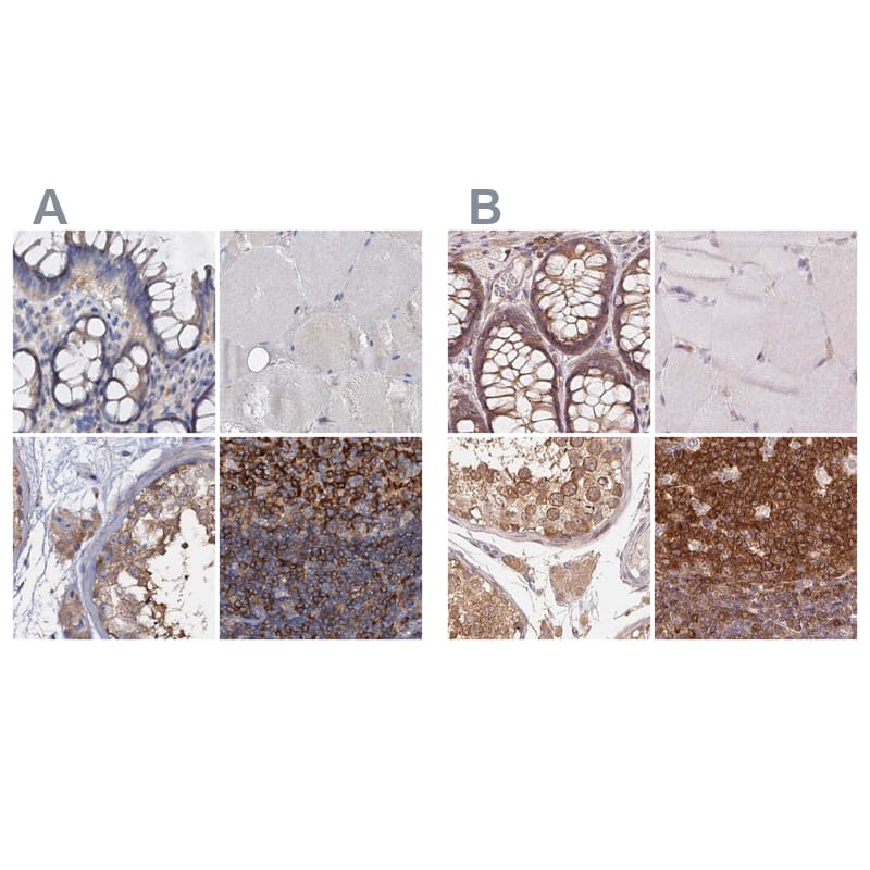 ANKRD13A Antibody - BSA Free Immunohistochemistry-Paraffin: ANKRD13A Antibody [NBP1-89082]