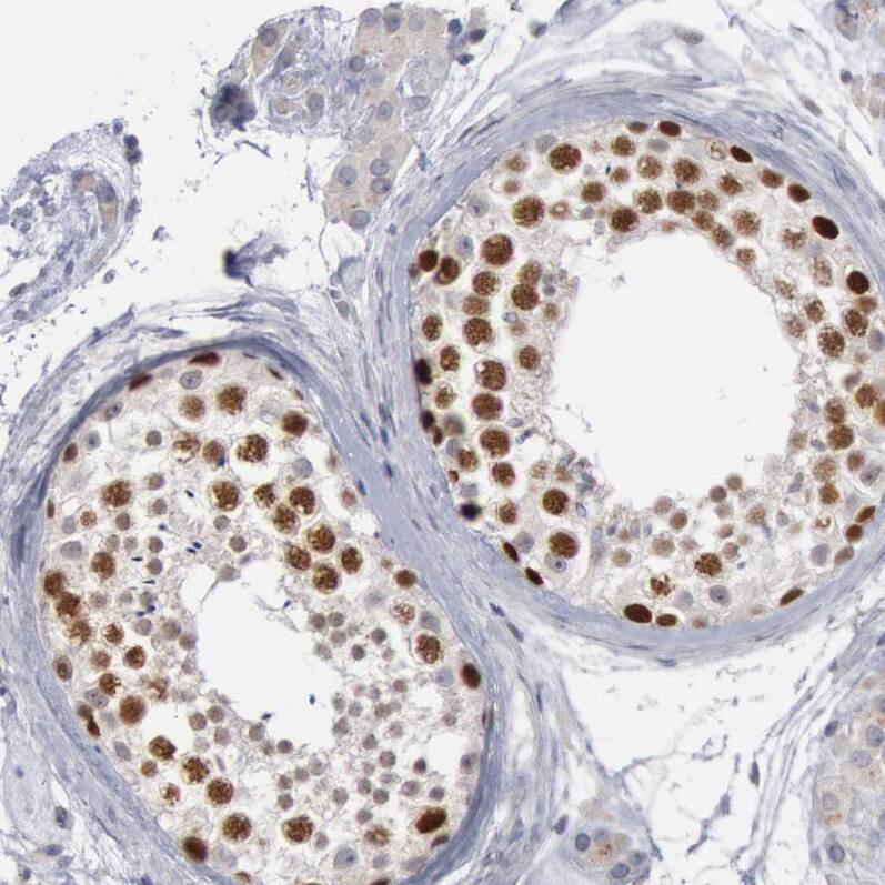 WDHD1 Antibody - BSA Free Immunohistochemistry-Paraffin: WDHD1 Antibody [NBP1-89091]