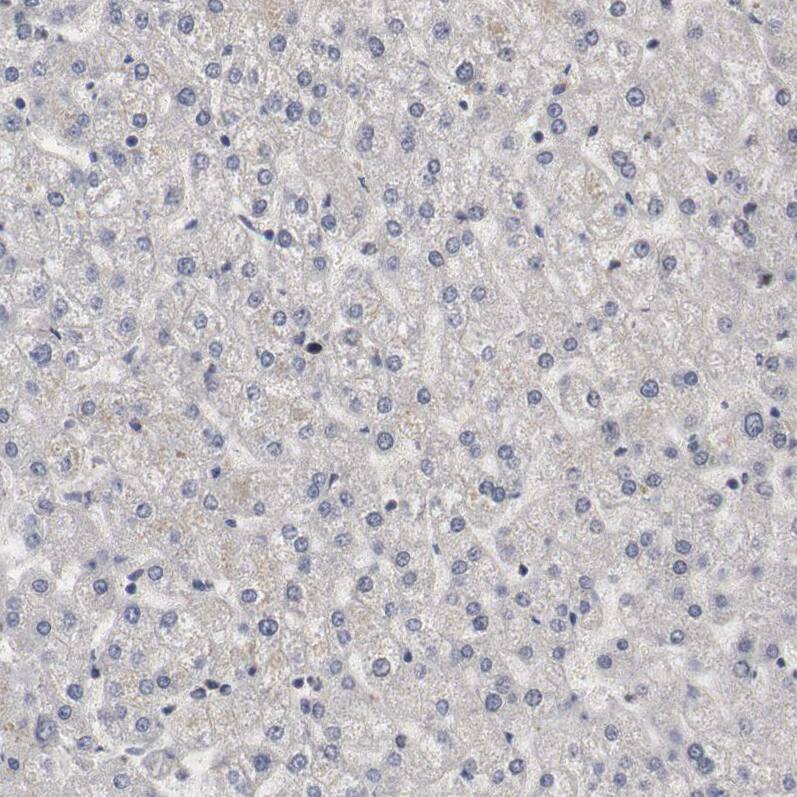WDHD1 Antibody - BSA Free Immunohistochemistry-Paraffin: WDHD1 Antibody [NBP1-89091]