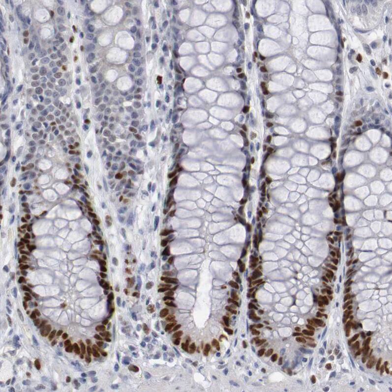 WDHD1 Antibody - BSA Free Immunohistochemistry-Paraffin: WDHD1 Antibody [NBP1-89091]