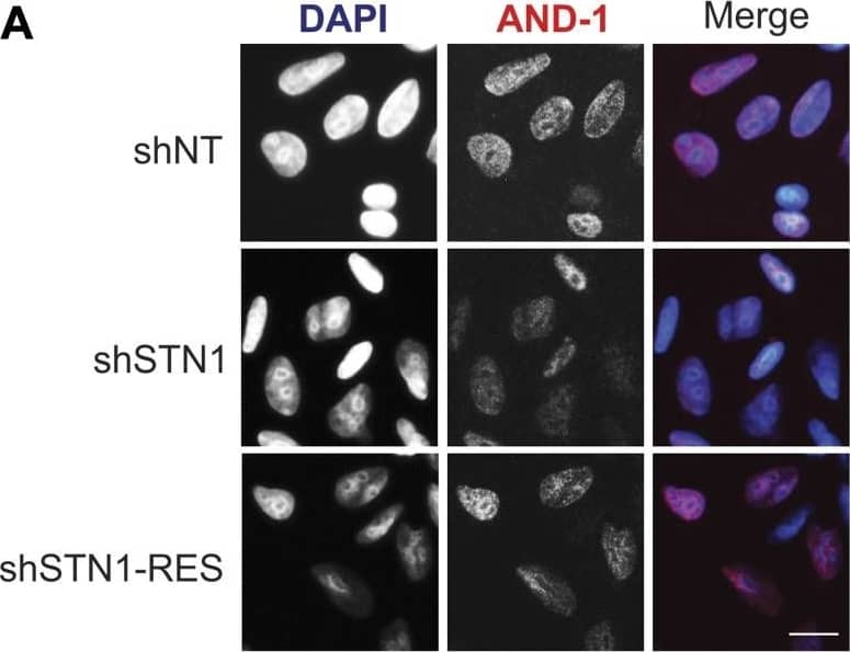 WDHD1 Antibody