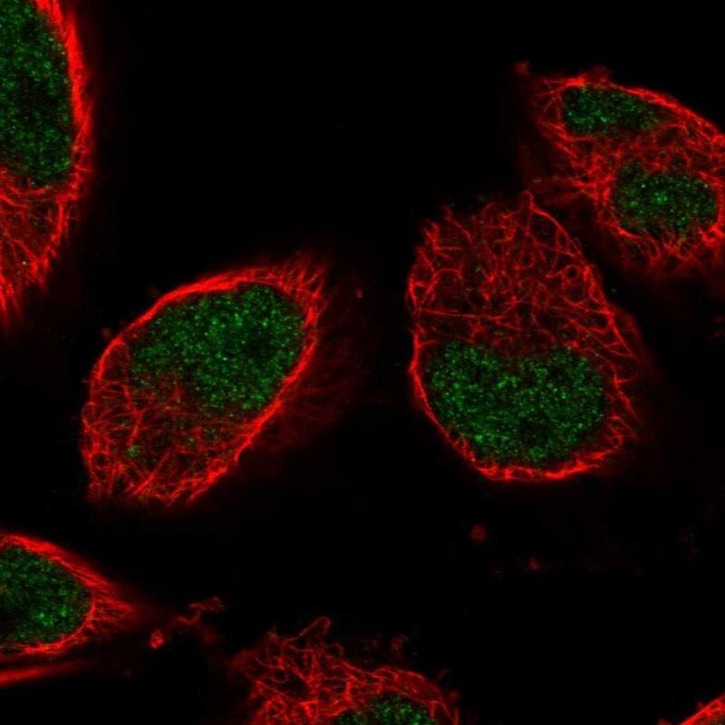 IGFALS/ALS Antibody - BSA Free Immunocytochemistry/ Immunofluorescence: IGFALS/ALS Antibody [NBP1-89117]