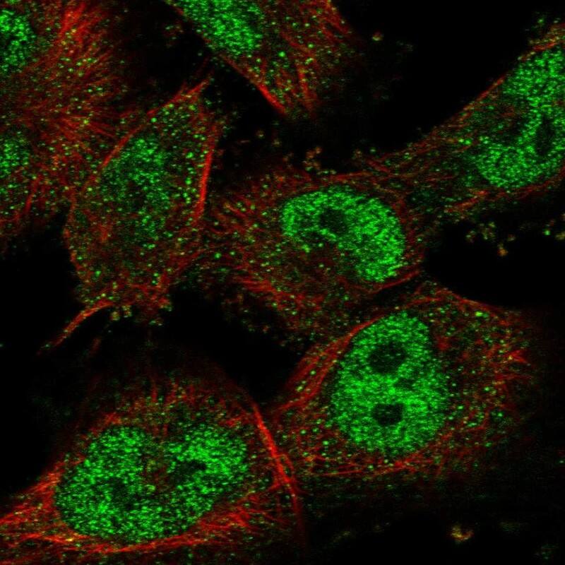 Nrf1 Antibody - BSA Free Immunocytochemistry/ Immunofluorescence: Nrf1 Antibody [NBP1-89125]