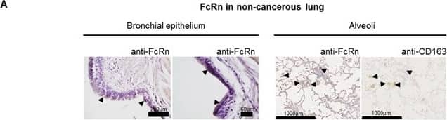 FCRN/FCGRT Antibody - BSA Free