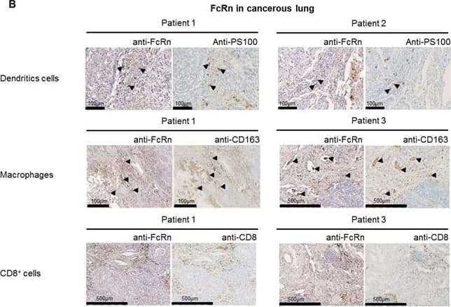 FCRN/FCGRT Antibody - BSA Free