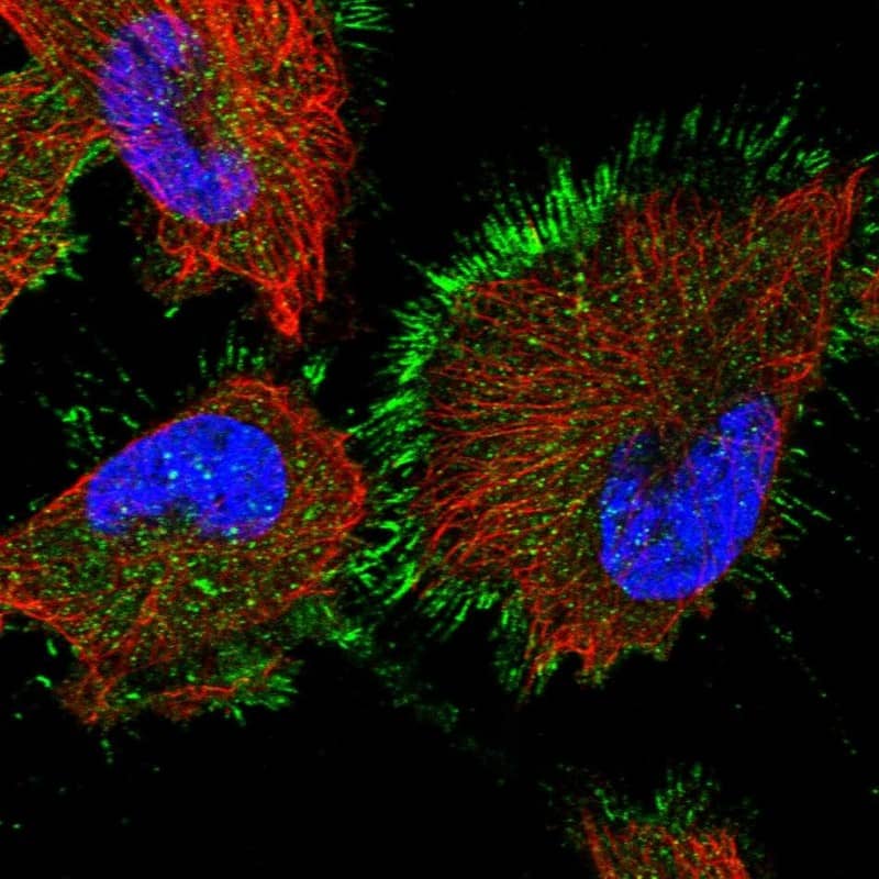AMSH-LP Antibody - BSA Free Immunocytochemistry/ Immunofluorescence: AMSH-LP Antibody [NBP1-89135]