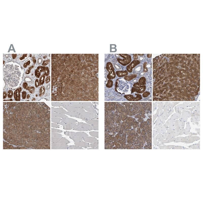 ALAD Antibody Immunohistochemistry-Paraffin: ALAD Antibody Antibody [NBP1-89157]