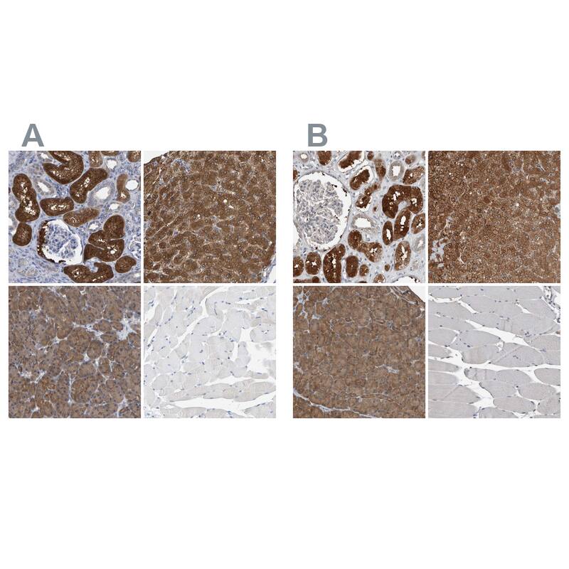 ALAD Antibody Immunohistochemistry-Paraffin: ALAD Antibody Antibody [NBP1-89158]