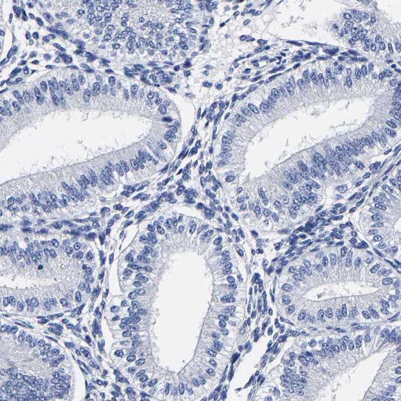 AKAP4 Antibody - BSA Free Immunohistochemistry-Paraffin: AKAP4 Antibody [NBP1-89164]