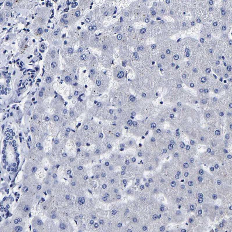 AKAP4 Antibody - BSA Free Immunohistochemistry-Paraffin: AKAP4 Antibody [NBP1-89164]