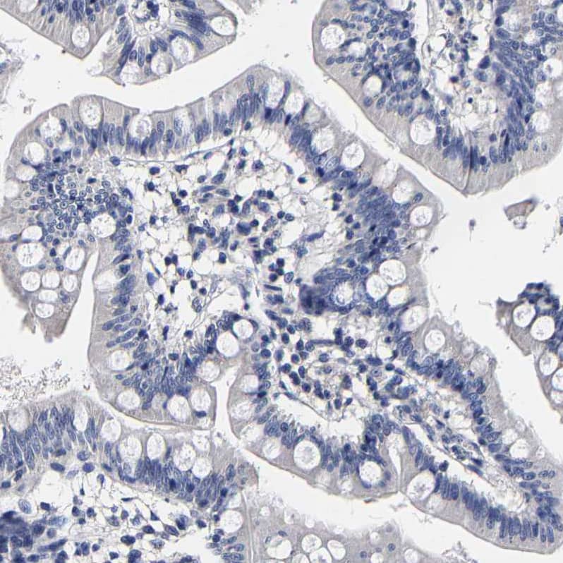 AKAP4 Antibody - BSA Free Immunohistochemistry-Paraffin: AKAP4 Antibody [NBP1-89164]