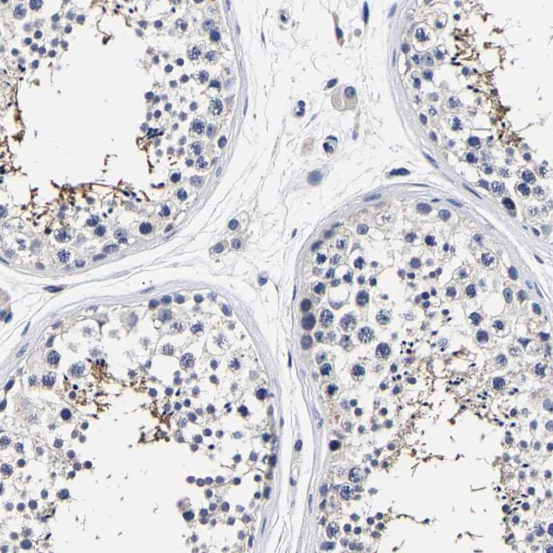 AKAP4 Antibody - BSA Free Immunohistochemistry-Paraffin: AKAP4 Antibody [NBP1-89164]
