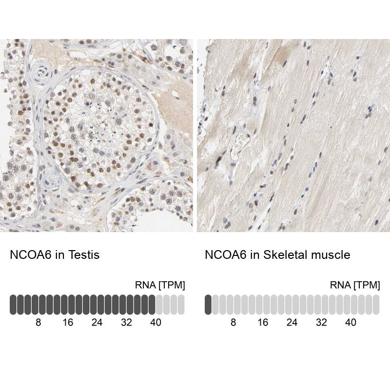 NCOA6 Antibody - BSA Free Immunohistochemistry-Paraffin: NCOA6 Antibody [NBP1-89193]