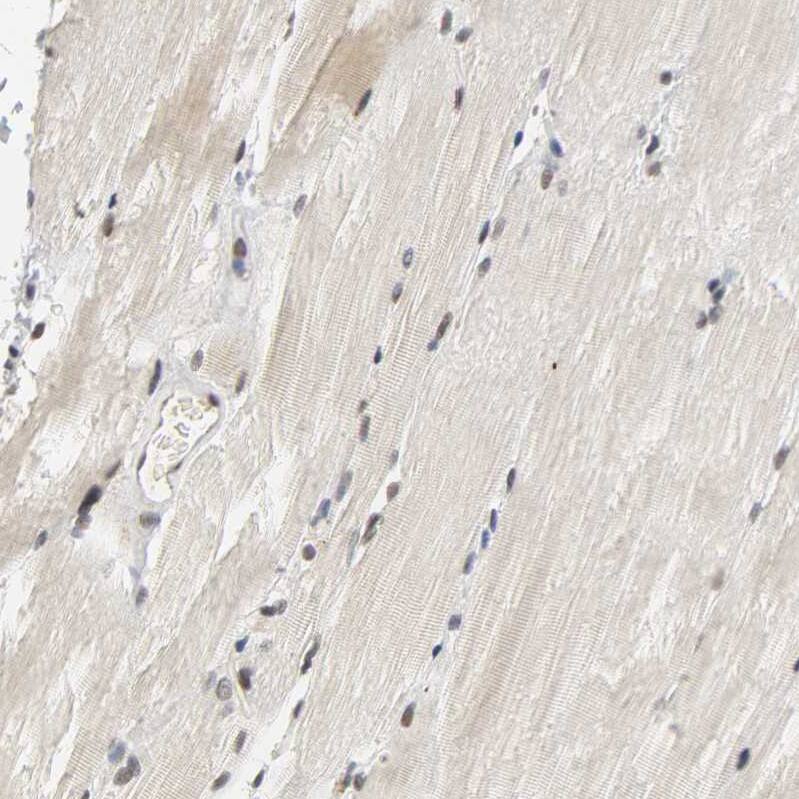 NCOA6 Antibody - BSA Free Immunohistochemistry-Paraffin: NCOA6 Antibody [NBP1-89193]