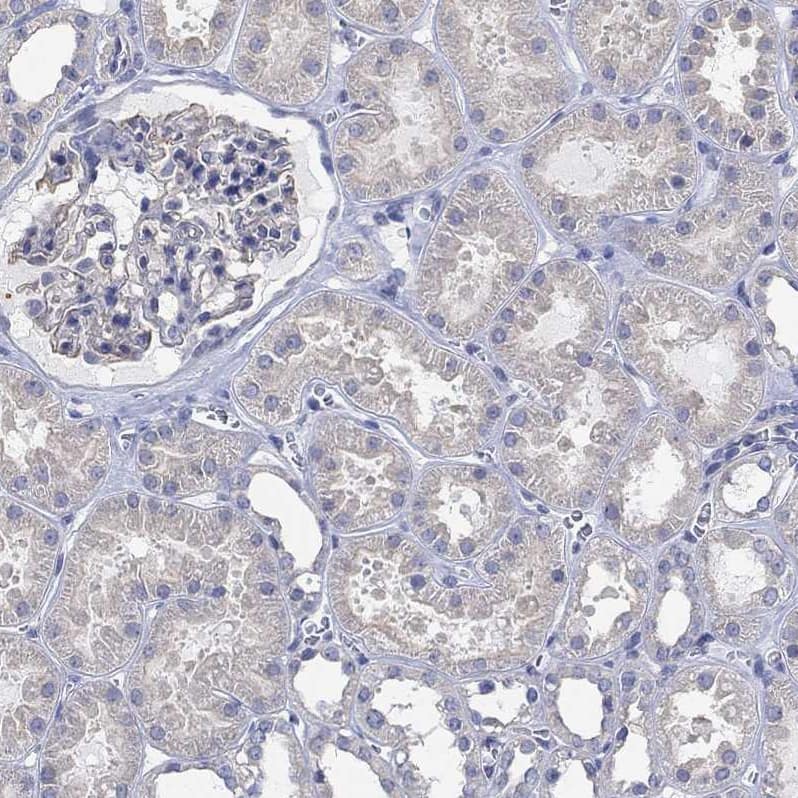 AgRP/ART Antibody - BSA Free Immunohistochemistry-Paraffin: AgRP/ART Antibody [NBP1-89203]