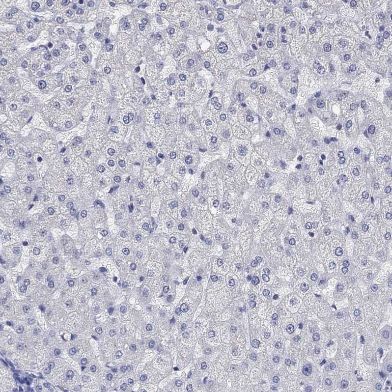 AgRP/ART Antibody - BSA Free Immunohistochemistry-Paraffin: AgRP/ART Antibody [NBP1-89203]