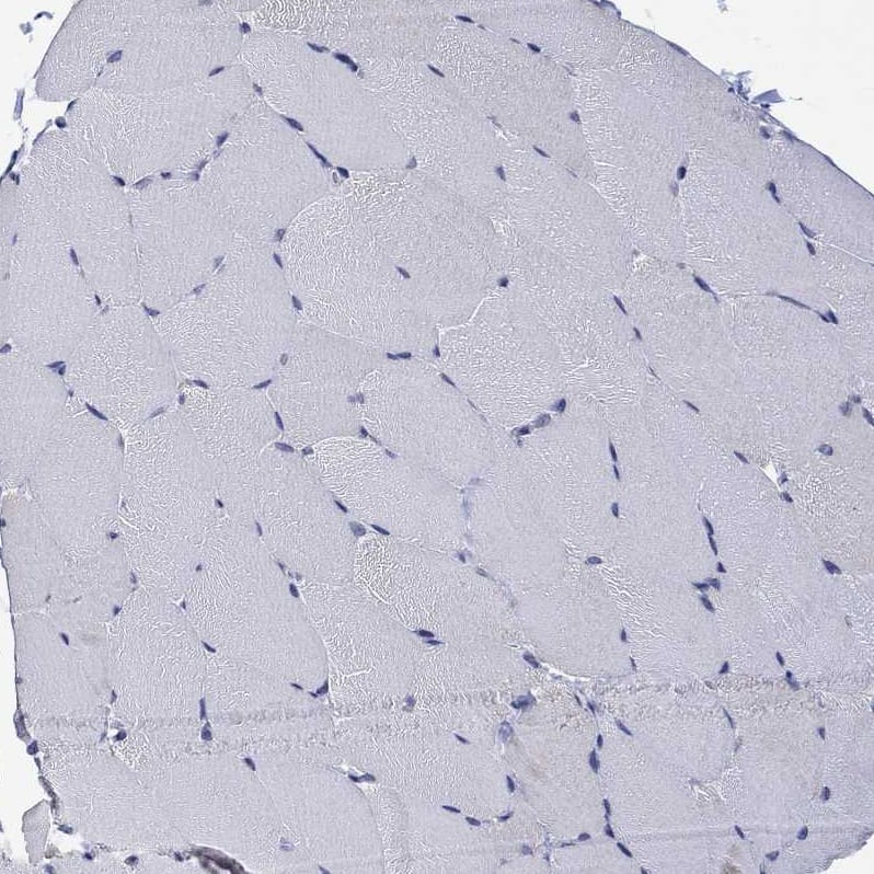 AgRP/ART Antibody - BSA Free Immunohistochemistry-Paraffin: AgRP/ART Antibody [NBP1-89203]