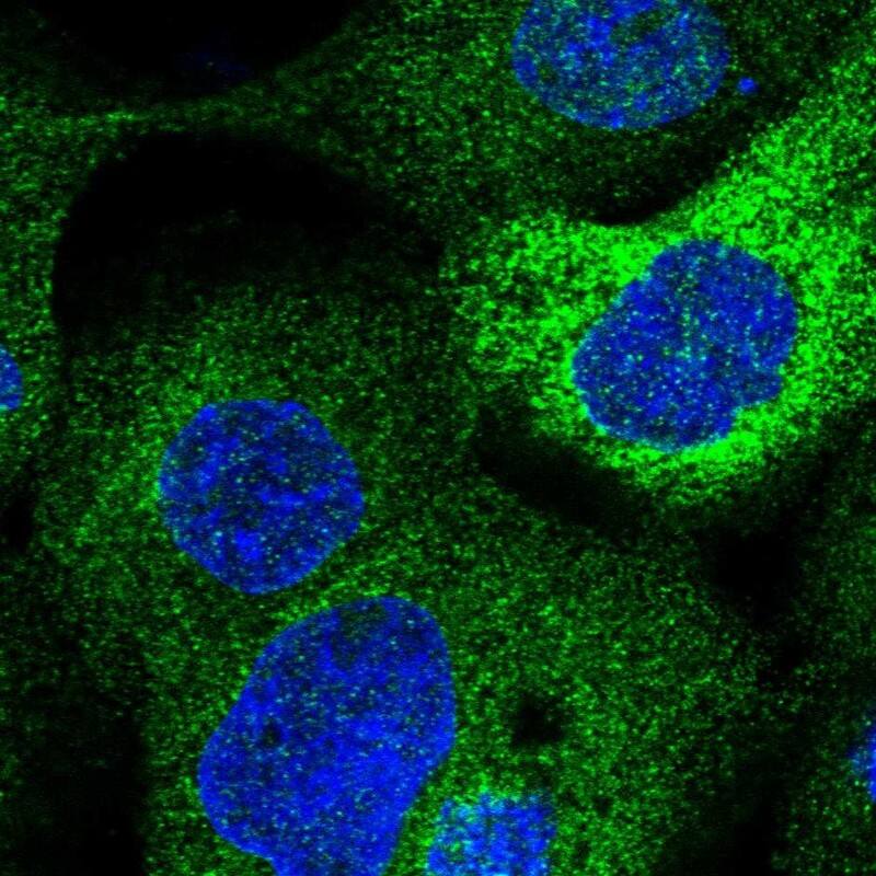 LCLAT1 Antibody - BSA Free Immunocytochemistry/ Immunofluorescence: LCLAT1 Antibody [NBP1-89204]