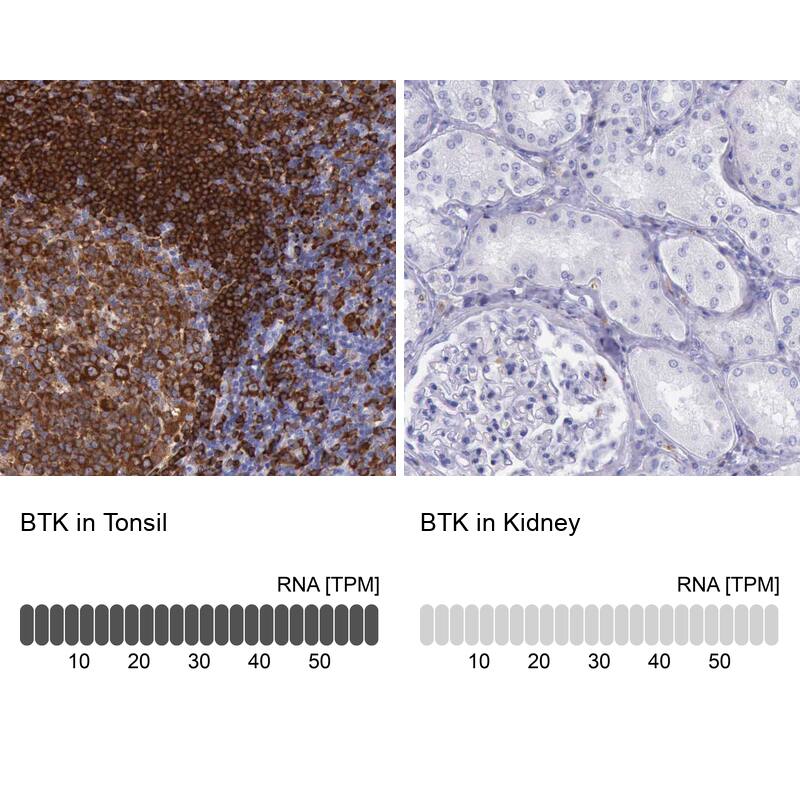 BTK Antibody - BSA Free Immunohistochemistry-Paraffin: BTK Antibody [NBP1-89207]