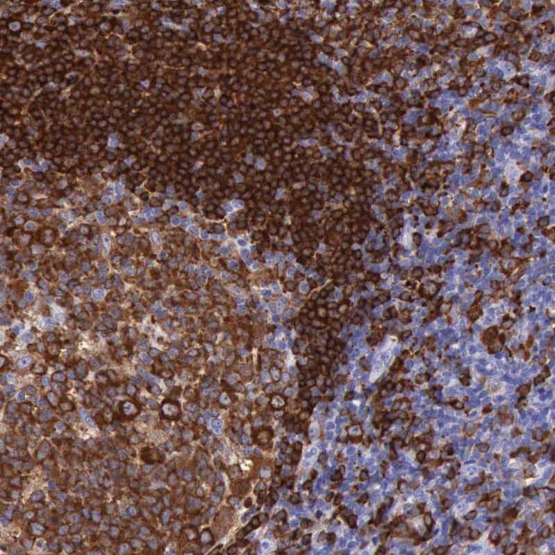 BTK Antibody - BSA Free Immunohistochemistry-Paraffin: BTK Antibody [NBP1-89207]