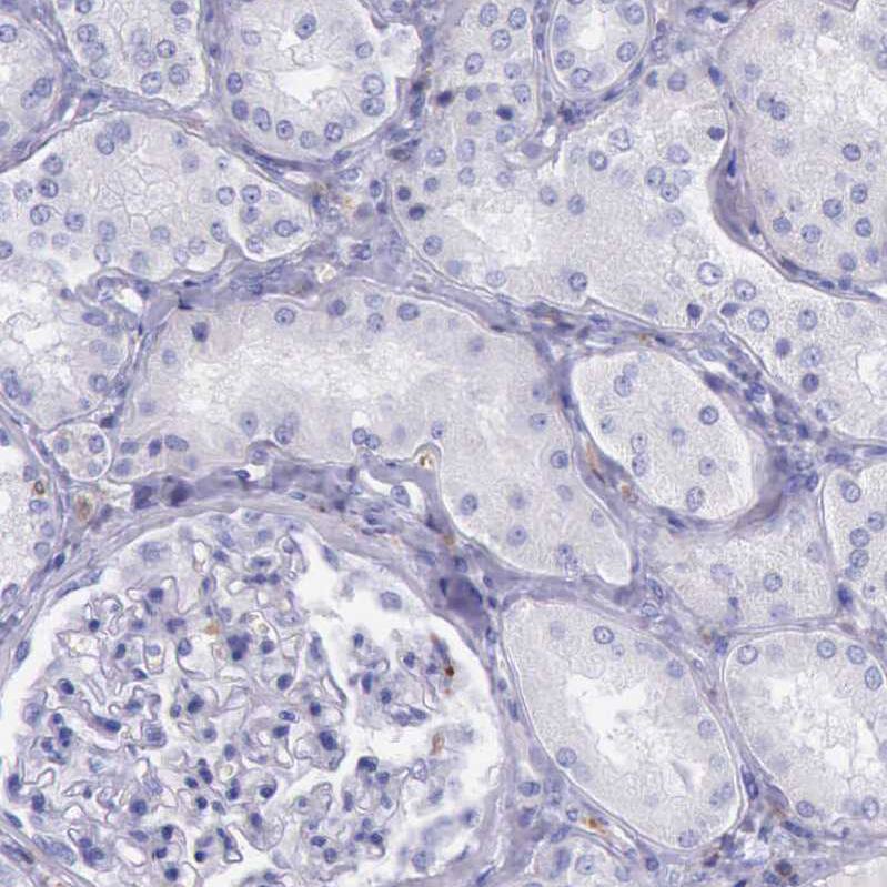 BTK Antibody - BSA Free Immunohistochemistry-Paraffin: BTK Antibody [NBP1-89207]