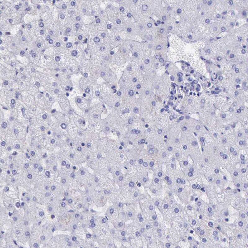 BTK Antibody - BSA Free Immunohistochemistry-Paraffin: BTK Antibody [NBP1-89207]