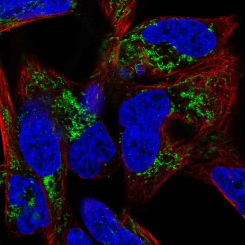GATM Antibody - BSA Free Immunocytochemistry/ Immunofluorescence: GATM Antibody [NBP1-89211]
