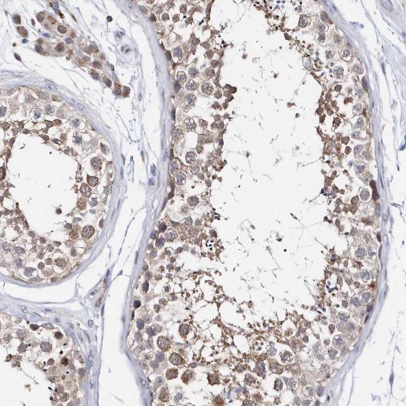 SPATA5 Antibody - BSA Free Immunohistochemistry-Paraffin: SPATA5 Antibody [NBP1-89214]