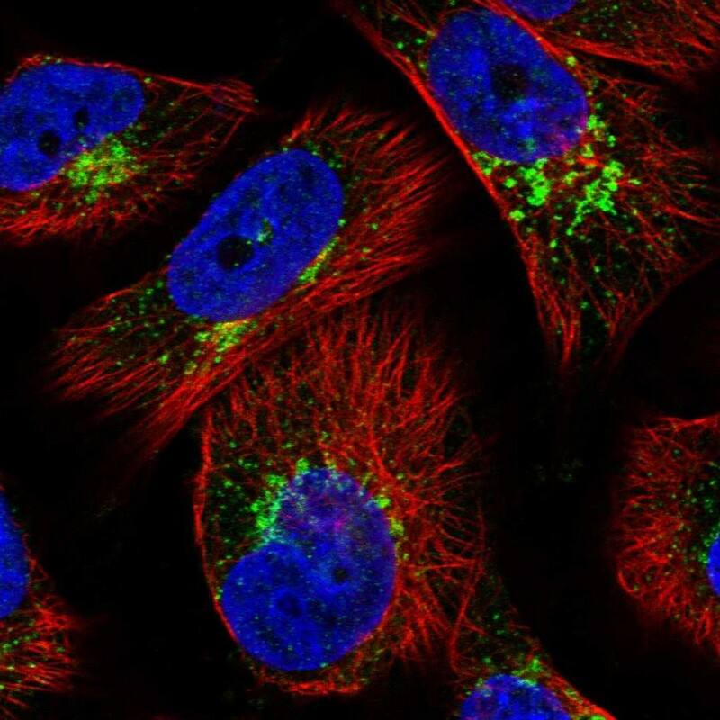 WDTC1 Antibody - BSA Free Immunocytochemistry/ Immunofluorescence: WDTC1 Antibody [NBP1-89234]