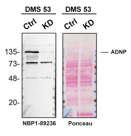 ADNP Antibody