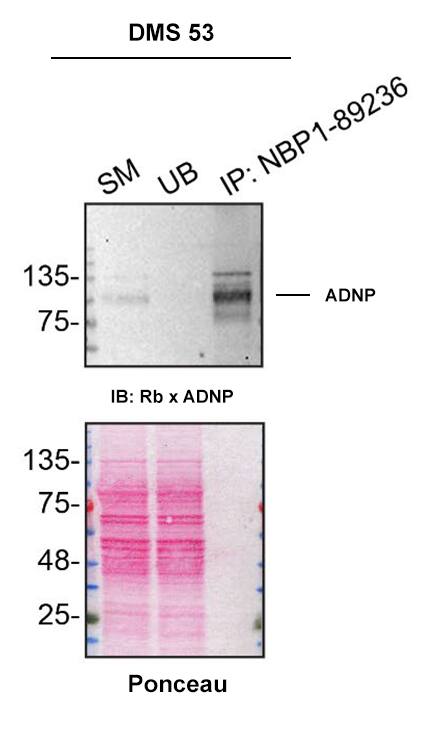 ADNP Antibody