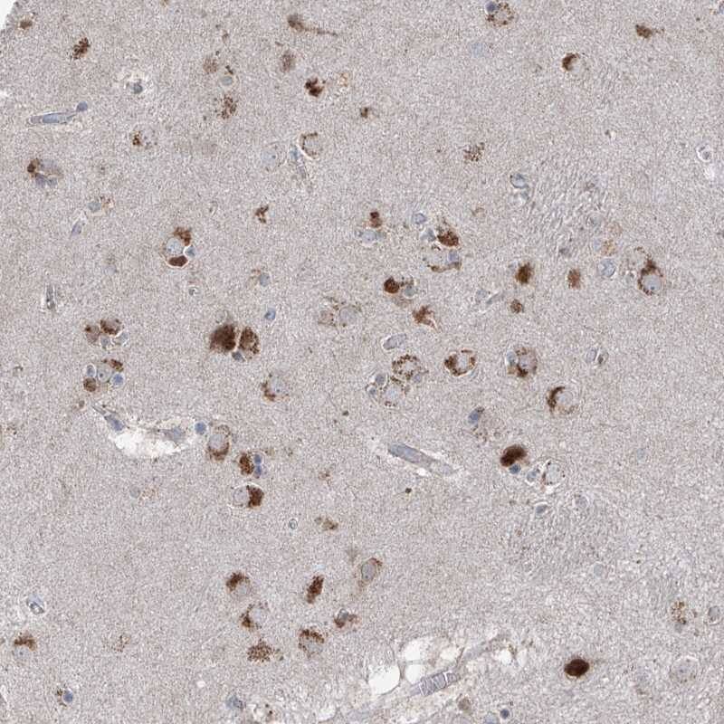 AGPS Antibody - BSA Free Immunohistochemistry-Paraffin: AGPS Antibody [NBP1-89240]