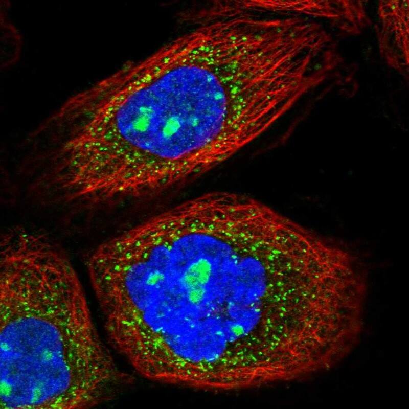 AGPS Antibody - BSA Free Immunocytochemistry/ Immunofluorescence: AGPS Antibody [NBP1-89241]