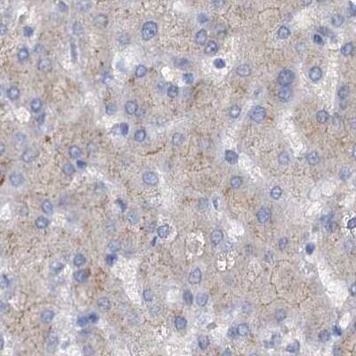 ACY3 Antibody - BSA Free Immunohistochemistry-Paraffin: ACY3 Antibody [NBP1-89256]