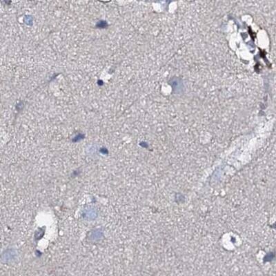 ACY3 Antibody - BSA Free Immunohistochemistry-Paraffin: ACY3 Antibody [NBP1-89256]